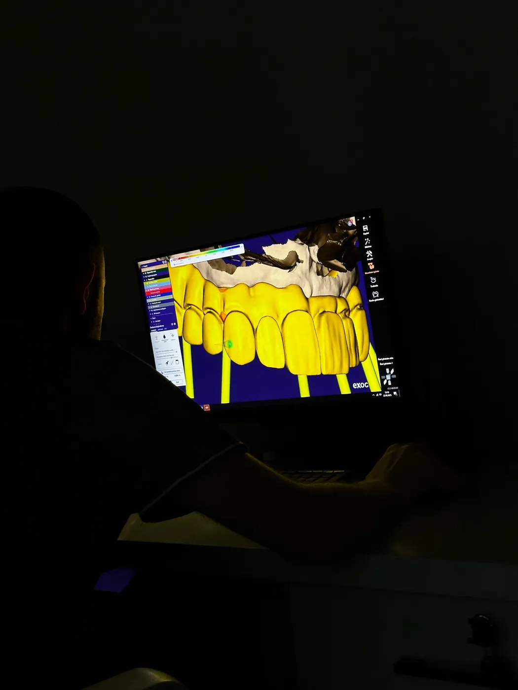 El diseño de una arcada en la pantalla del laboratorio